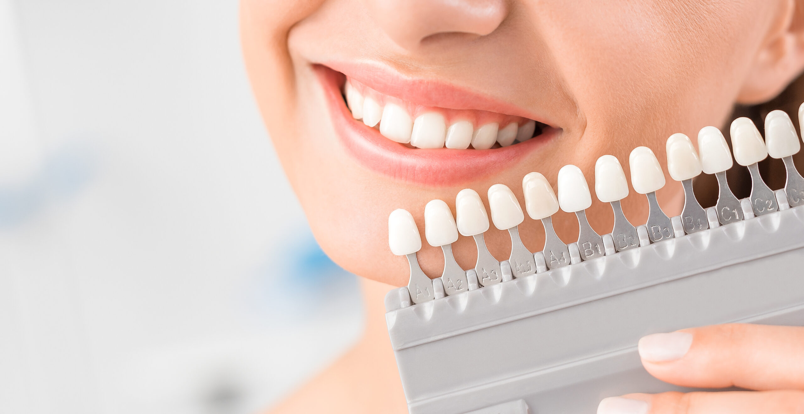 Beautiful smile and white teeth of a young woman after visiting Mishikawa cosmetic dentist